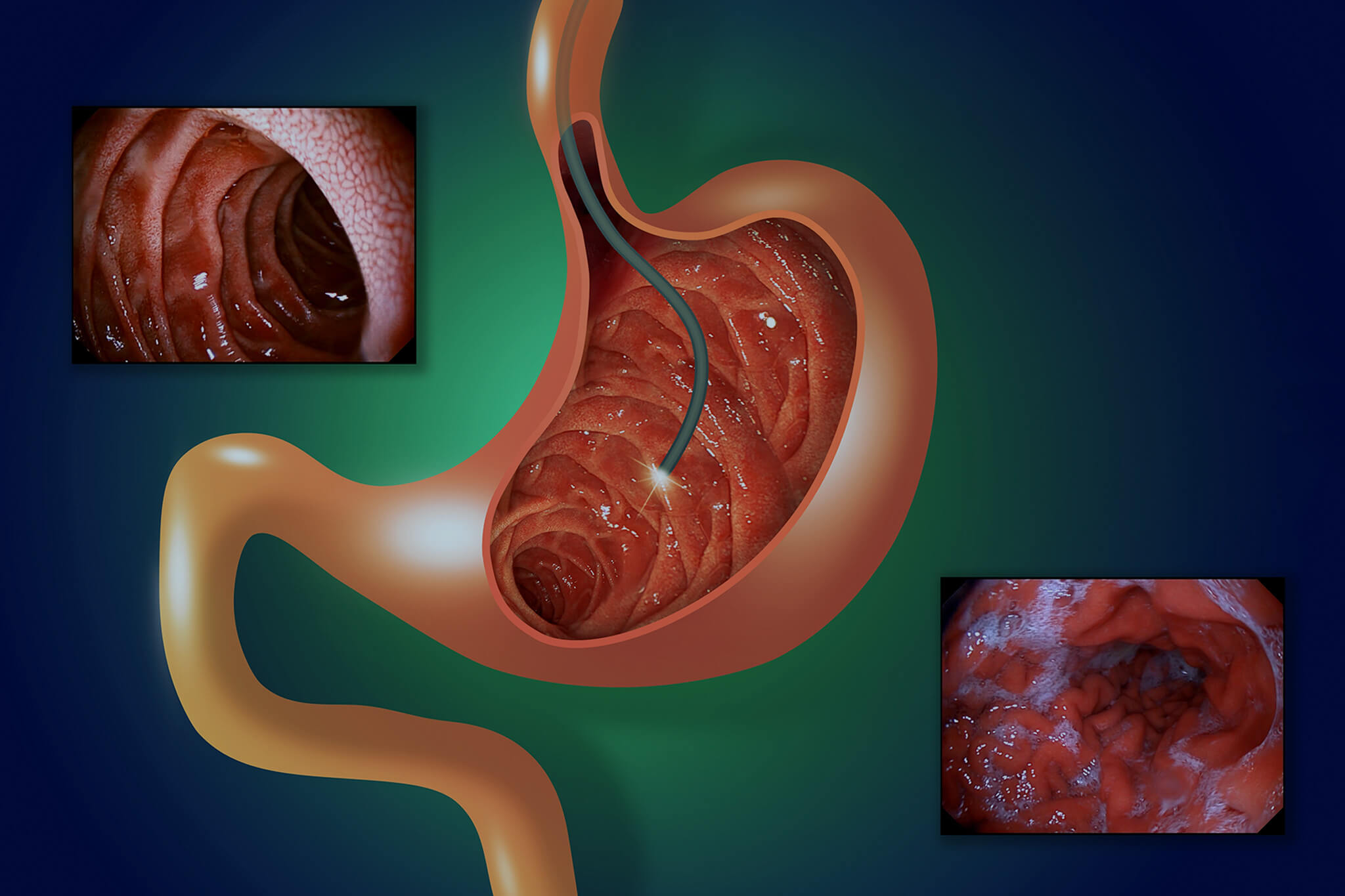 Diagnostics of gastric diseases.