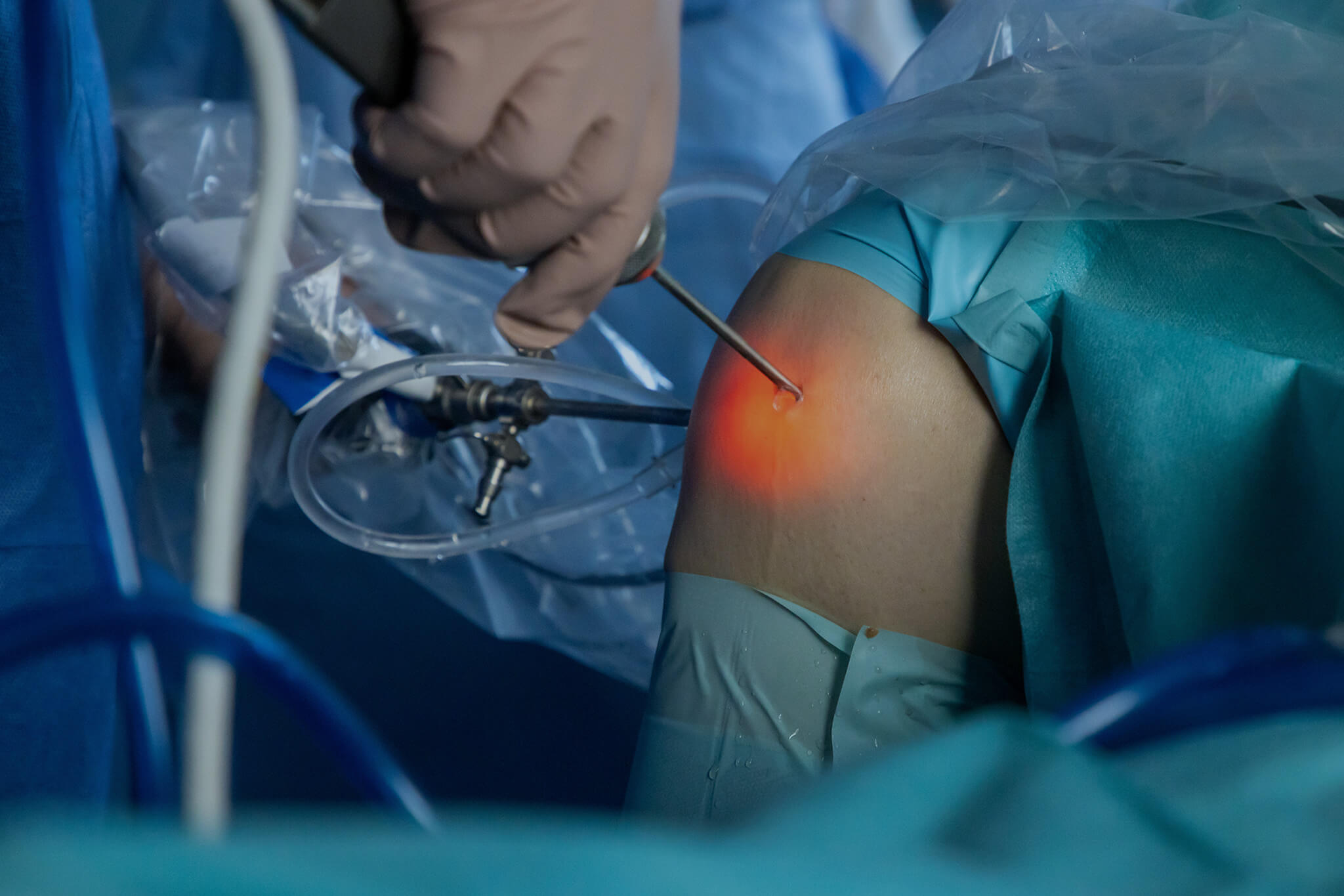 Knee arthroscopy in an orthopedic clinic.