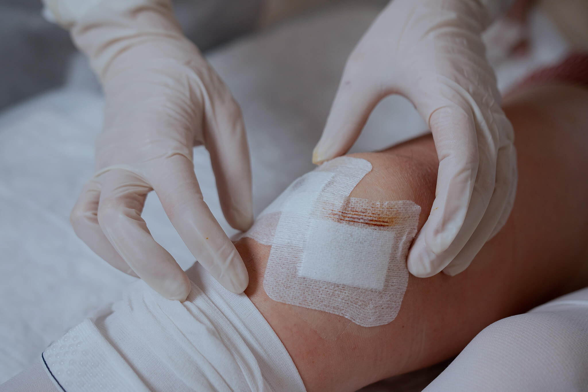 Nurse putting a sterile patch on the patient's knee after arthroscopy surgery.