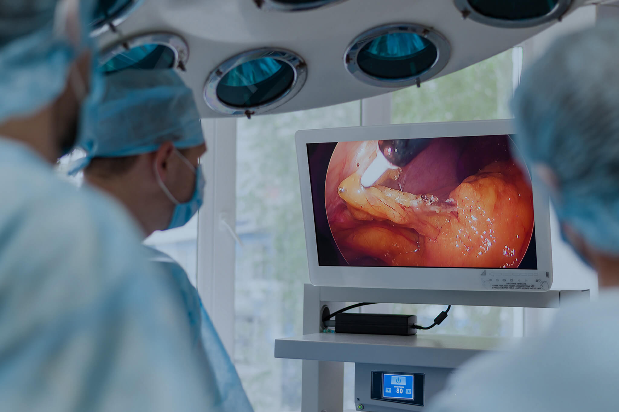 Doctors looking at the monitor in the operation room.