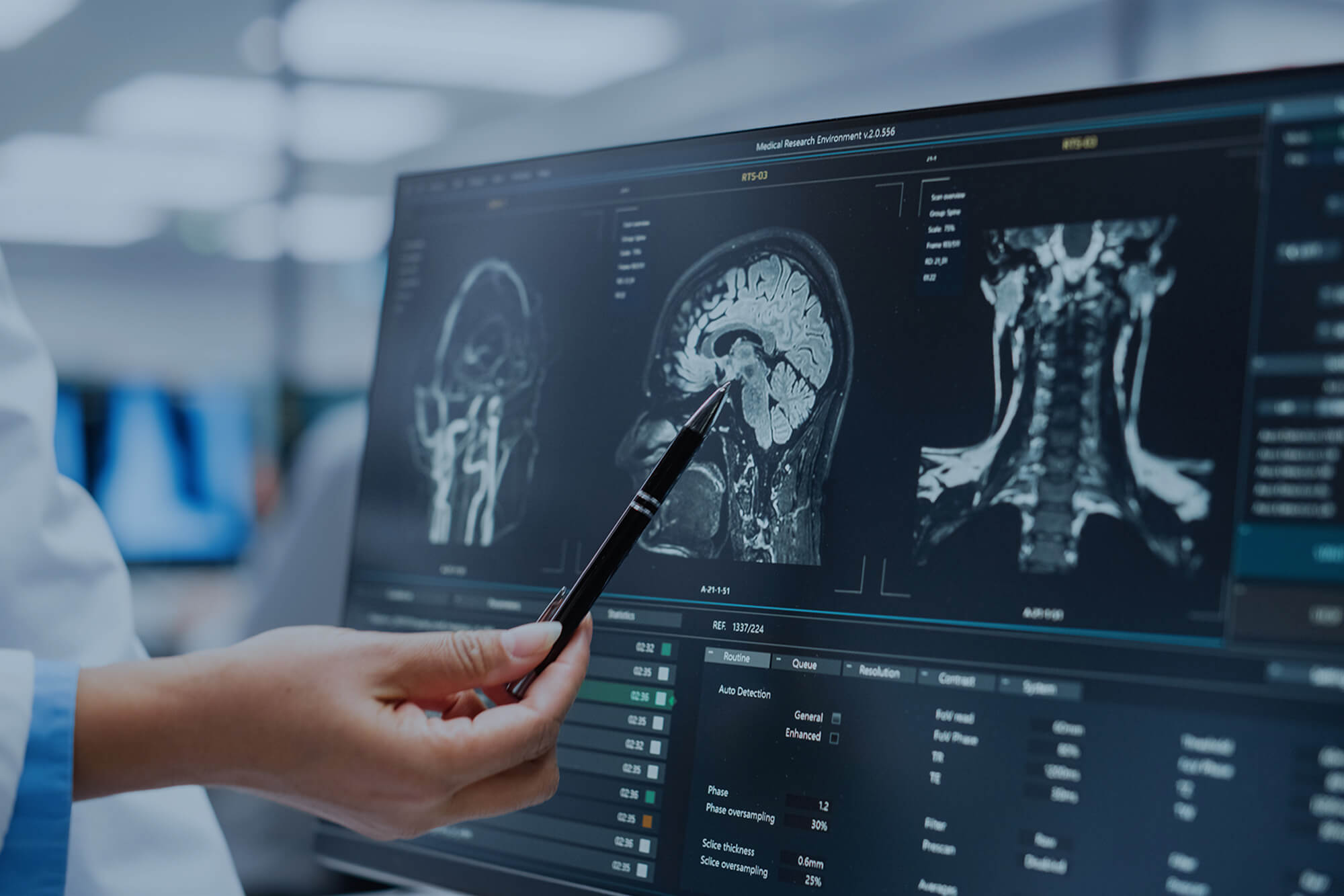 Neurologist pointing at the CT scan.