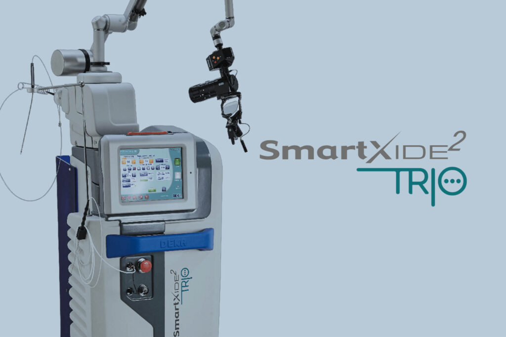 DEKA SmartXide2 TRIO