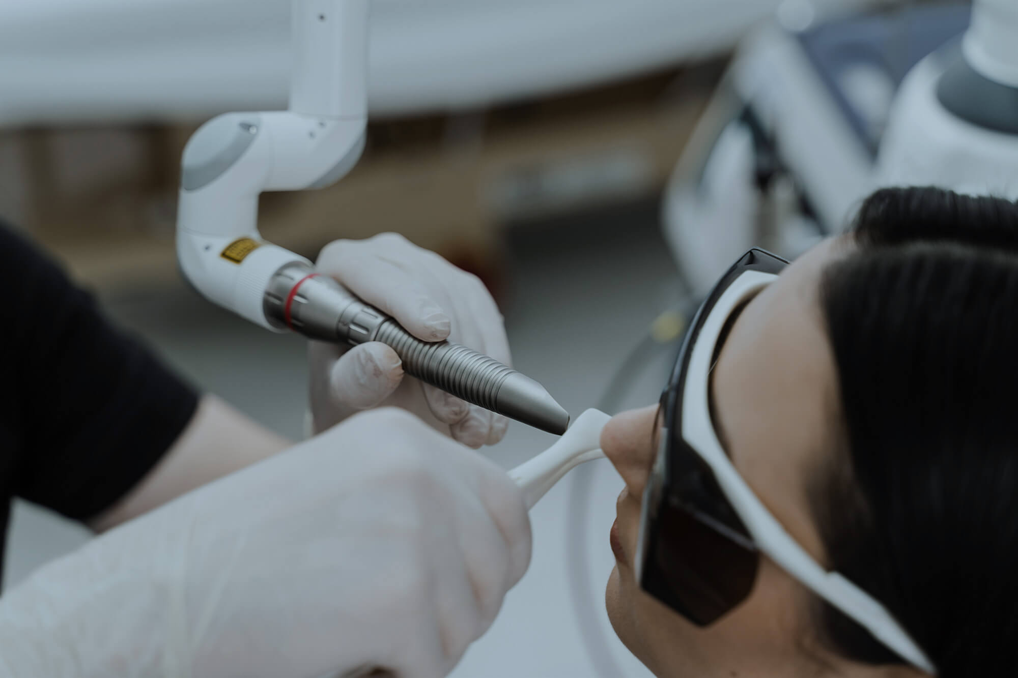 Chronic rhinitis treatment with laser.